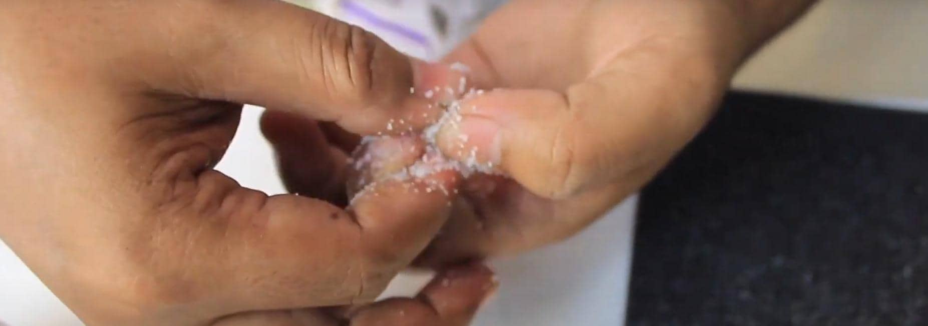 Rahasia Garam dan Super Glue: Cara Ampuh Menghilangkan Lem di Kulit
